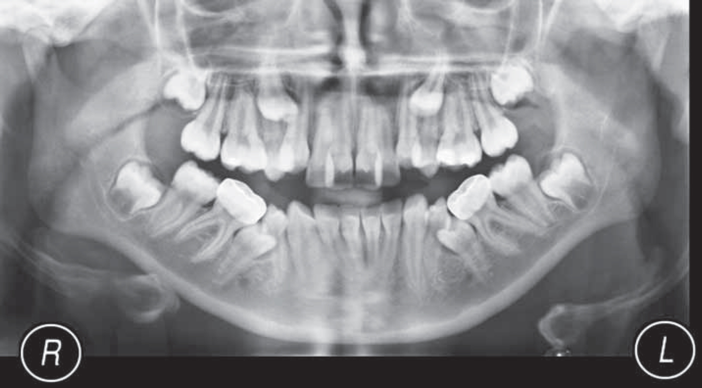 Orthodontic Update - Multidisciplinary Care – How Should We Manage The ...